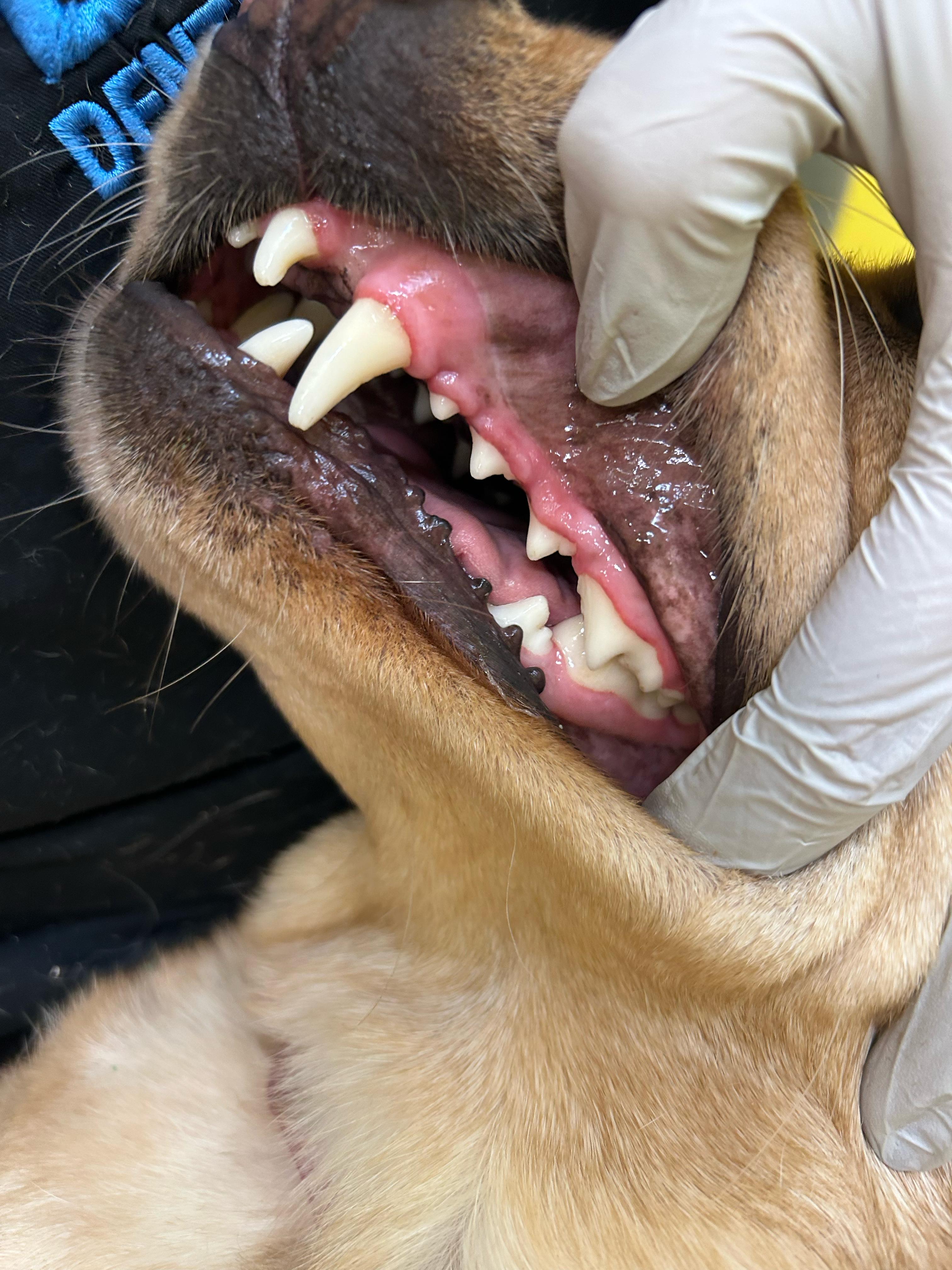 After - Full mouth restoration